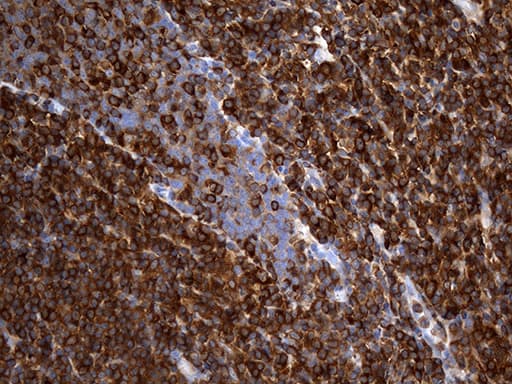ACTR3 Antibody (aa2-418, clone OTI5G4)
