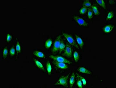 TRPM2 Antibody (aa60-119)