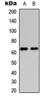Polyclonal Rabbit anti-Human HABP2 Antibody (Internal, WB)