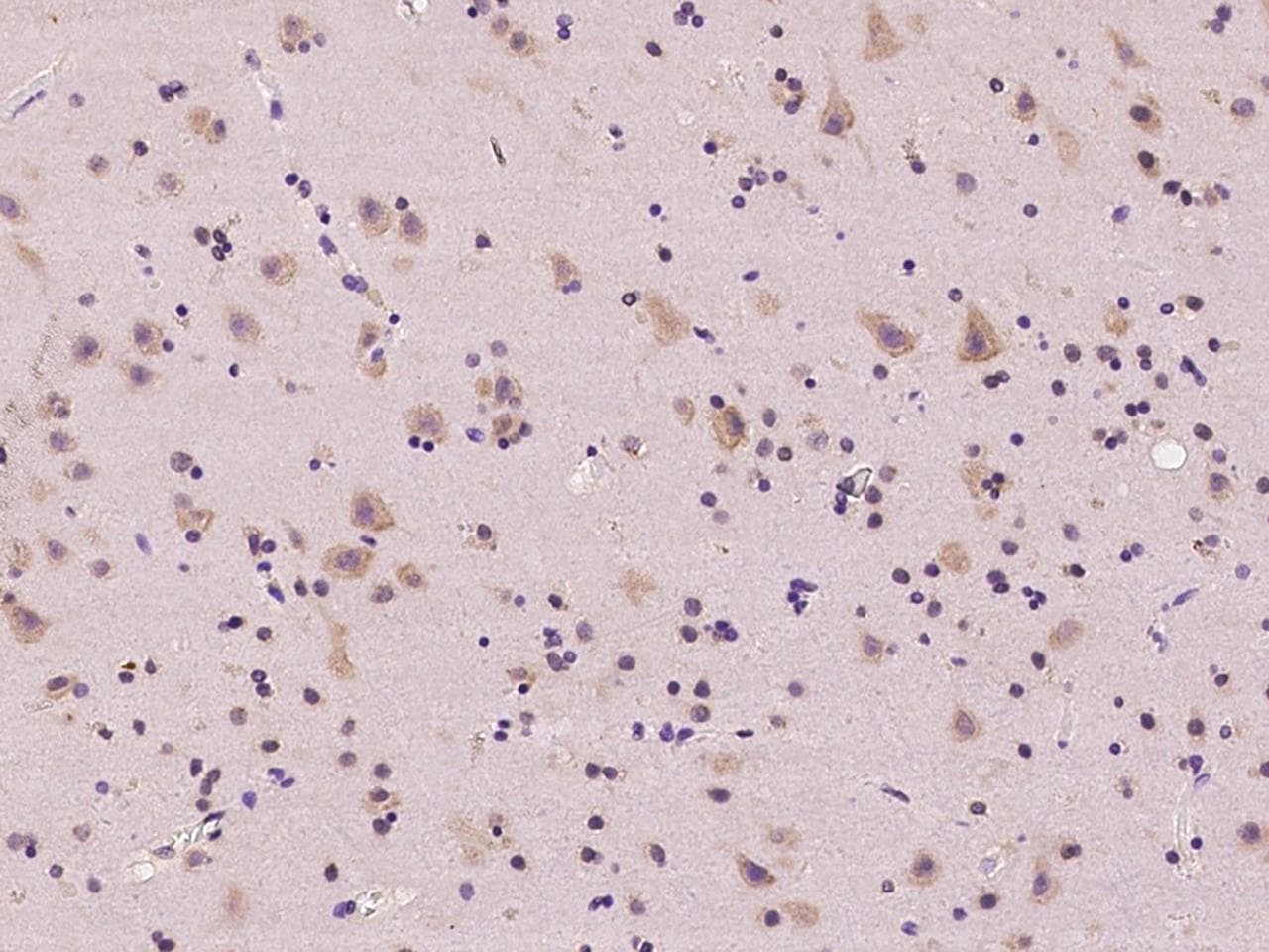 RPL36 / Ribosomal Protein L36 Antibody