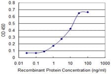 Monoclonal Mouse anti-Human p56lck / LCK Antibody (clone 3F7-F5, WB)