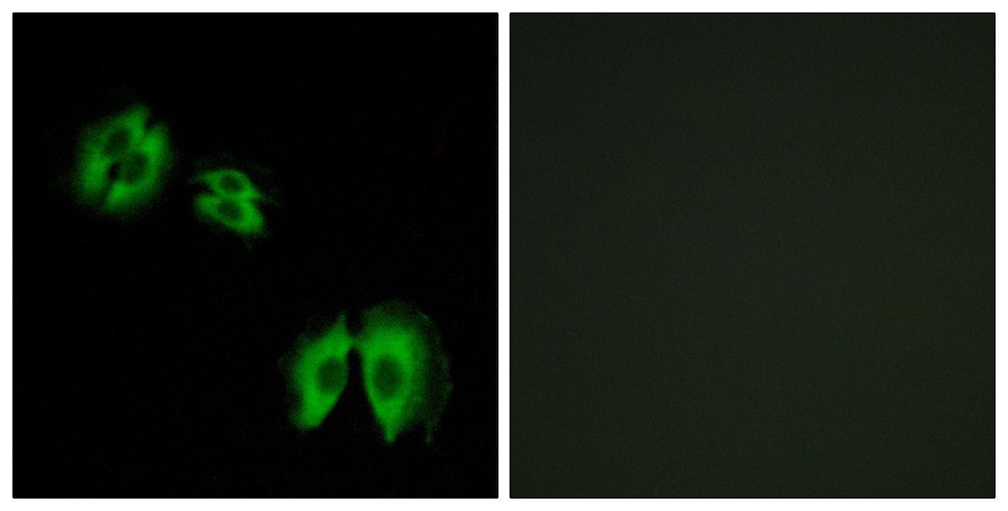 GLCT2 / B3GALT2 Antibody