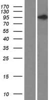 DIS3L2 Protein (Over-Expression Lysate Myc-DDK (Flag))