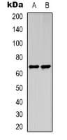 Polyclonal Rabbit anti-Human STRA8 Antibody (Internal, WB)