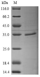 Human RPSA / Laminin Receptor Protein (Recombinant 6His, N-terminus)