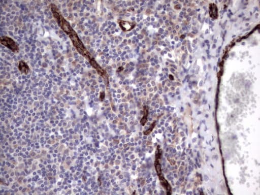 VWF / Von Willebrand Factor Antibody (aa764-1263, clone OTI2D11)