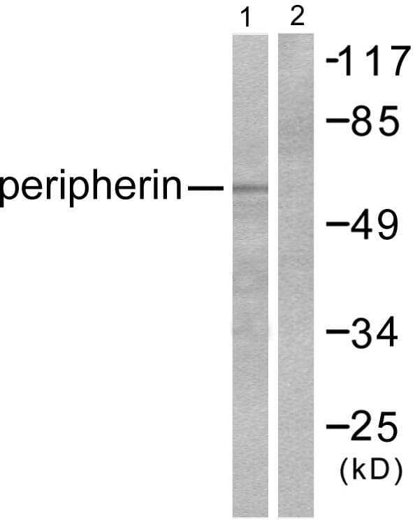 Peripherin Antibody (aa455-470)