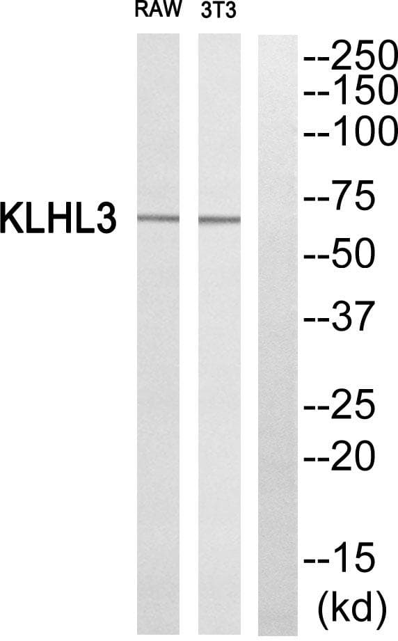 Polyclonal Rabbit anti-Human KLHL3 Antibody (IHC, IF, WB)