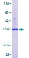 Human APRT Protein (Recombinant GST)