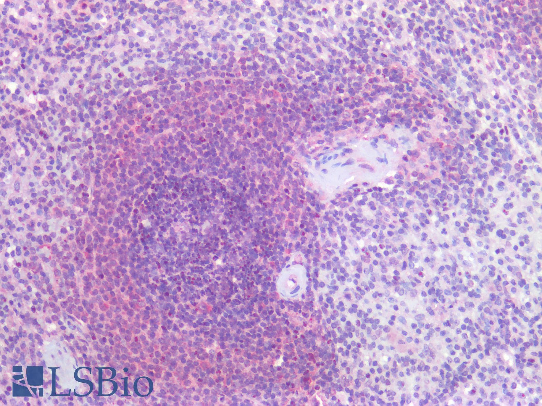 IHC-plus™ PARP1 Antibody