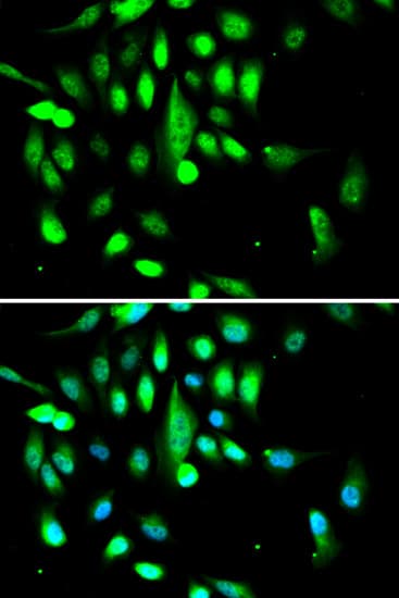 CDK1 / CDC2 Antibody