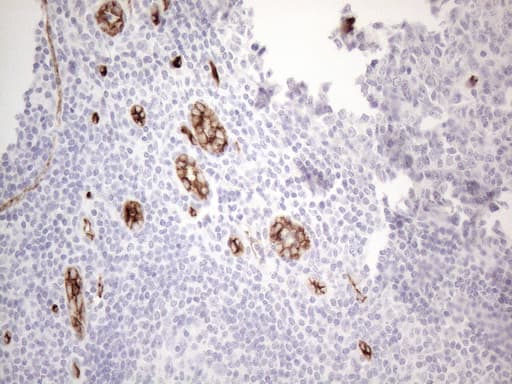 Monoclonal Mouse anti-Human CD34 Antibody (clone OTI11E1, Carrier-free, aa312-385, IHC, WB)