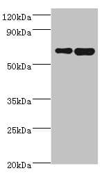 Polyclonal Rabbit anti-Human STXBP3 Antibody (aa343-592, IHC, WB)