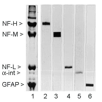Monoclonal Mouse anti-Human NEFM / NF-M Antibody (clone 3H11, IF, WB)