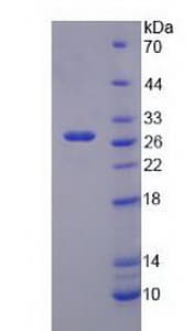 Human KCNJ10 / SESAME / KIR4.1 Protein (Recombinant His-T7)