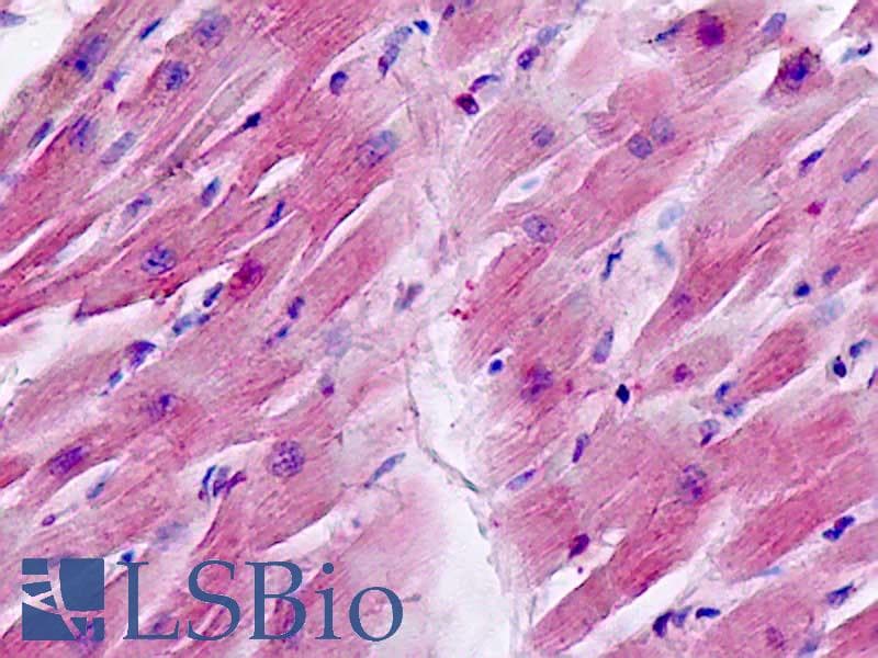 IHC-plus™ CYSLTR1 / CYSLT1 Antibody (aa131-180)
