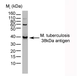 Monoclonal Mouse anti-Bacteria MTB 38kD Antigen Antibody (clone BGN/1209/3875, WB)