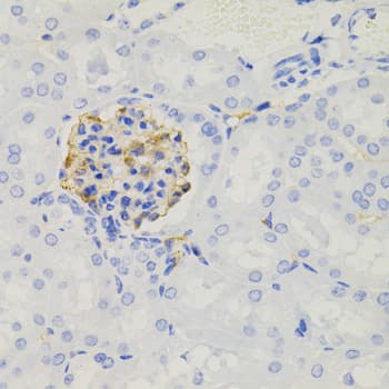 NPHS1 / Nephrin Antibody