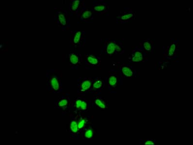 Polyclonal Rabbit anti-Human HIST1H2BB Antibody (IF)