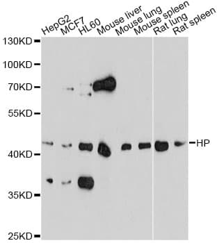 PathPlus™ HP / Haptoglobin Antibody