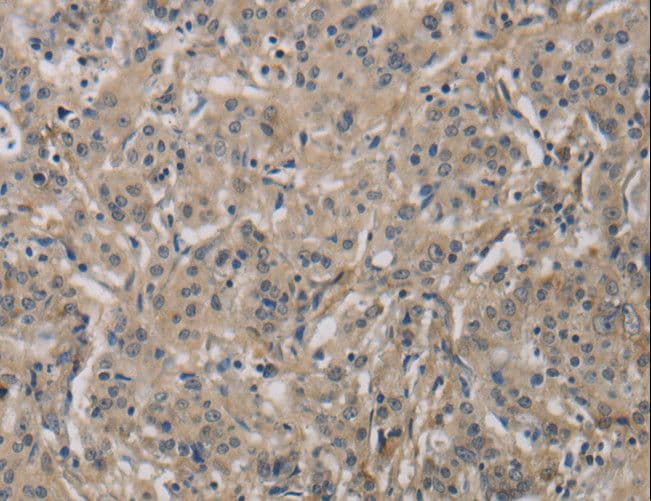 DCN / Decorin Antibody