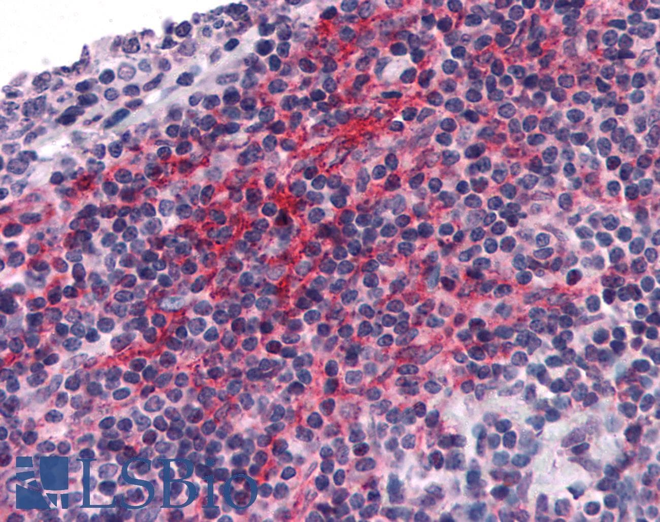 IHC-plus™ Polyclonal Rabbit anti-Human ZNF687 Antibody (IHC)