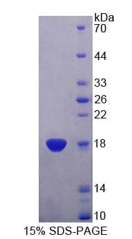Human TRAPPC2 / SEDL Protein (Recombinant His-T7)