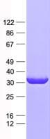 Human PSMB7 Protein (Recombinant His, N-Terminal)