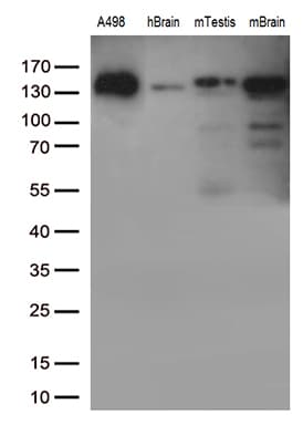 Monoclonal Mouse anti-Human CDH2 / N Cadherin Antibody (clone UMAB23, IHC, IF, WB)