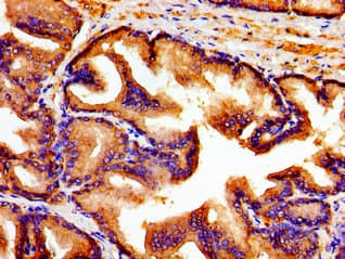 ARTN / Artemin Antibody