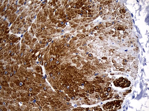 Monoclonal Mouse anti-Human C1orf111 Antibody (clone OTI2A9, IHC, WB)