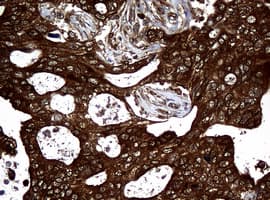 NME1 / NM23 Antibody (clone OTI4H2)
