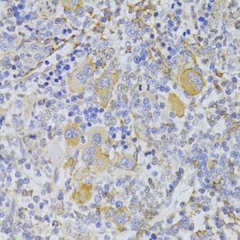 Polyclonal Rabbit anti-Human SNAI2 / SLUG Antibody (IHC, IF, WB)