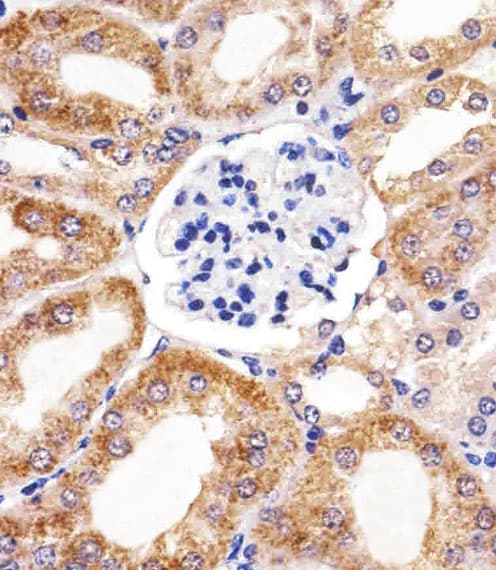 Monoclonal Mouse anti-Human BCL10 / BCL-10 Antibody (clone 1185CT13.2.1.2, aa1-143, IHC, WB)
