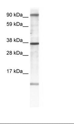 Polyclonal Rabbit anti-Human AKAP7 Antibody (N-Terminus, IHC, WB)