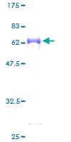 Human SUGT1 / SGT1 Protein (Recombinant GST)