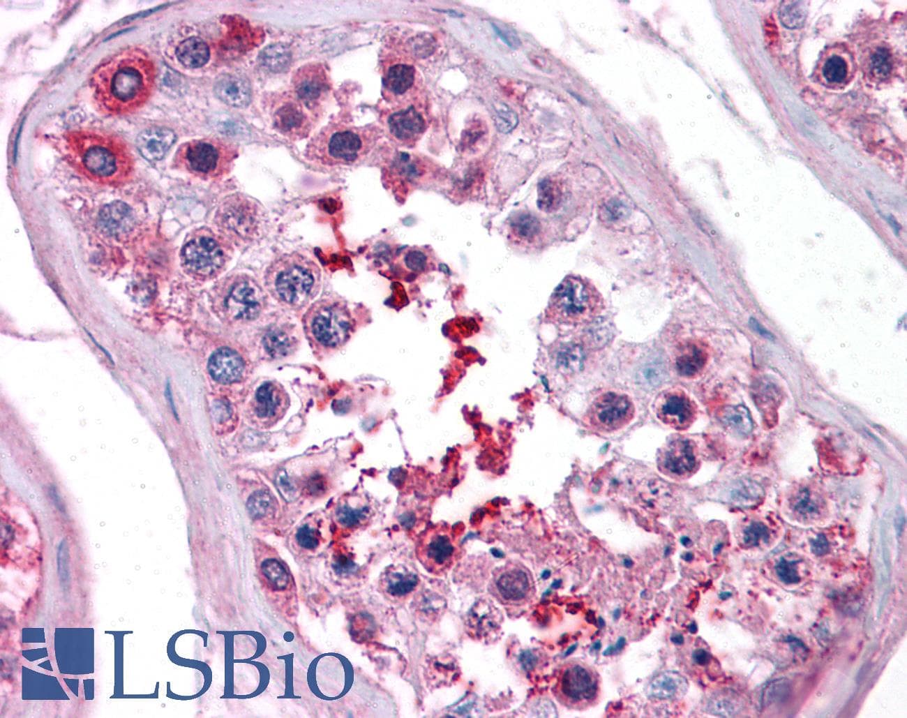 IHC-plus™ C13orf34 / BORA Antibody