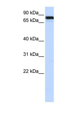 Polyclonal Rabbit anti-Human EWSR1 / EWS Antibody (aa216-265, WB)