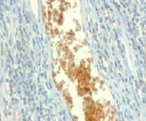 AMPD3 Antibody (clone ETAD3-1, Azide-free, BSA-free)