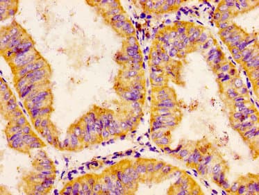 Polyclonal Rabbit anti-Human CHRDL1 Antibody (IHC, WB)