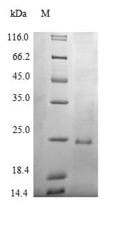 Human SIRPG Protein (Recombinant 6His, N-terminus)
