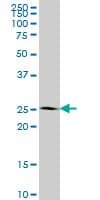 Monoclonal Mouse anti-Human IDI1 / IPP1 Antibody (clone 6G10, WB)
