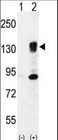 ITGA5/Integrin Alpha 5/CD49e Antibody (aa575-602)