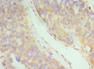 IFNAR2 Antibody (aa27-243)