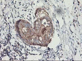 Monoclonal Mouse anti-Human MTFMT Antibody (clone OTI1E7, aa175-389, IHC, WB)