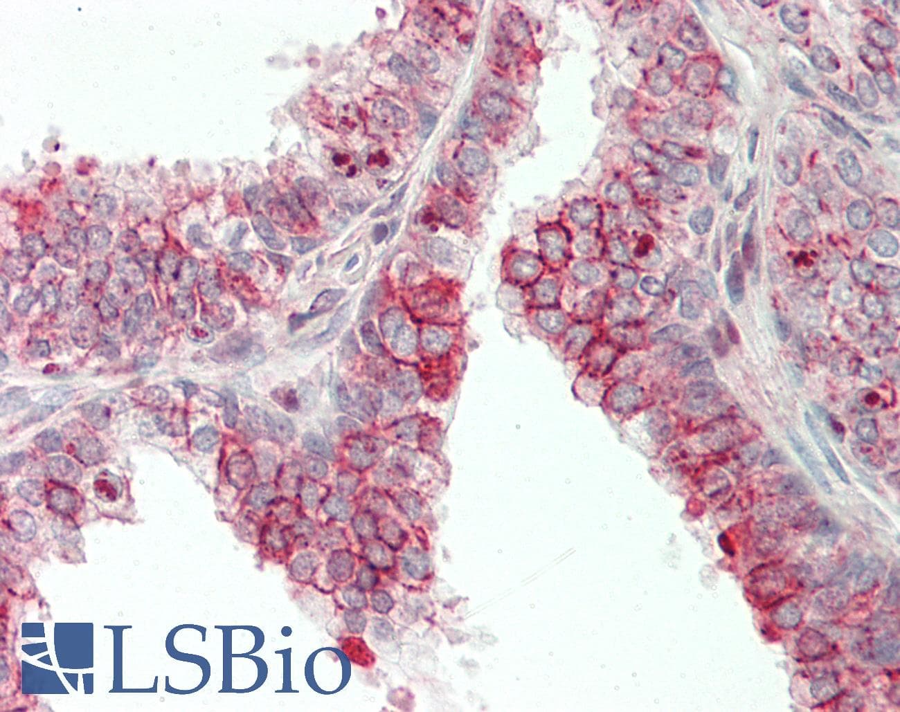 IHC-plus™ DKK2 Antibody (aa31-62)