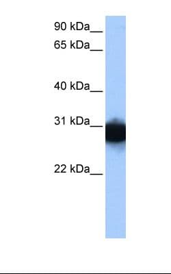 TPI1 / TPI Antibody (N-Terminus)