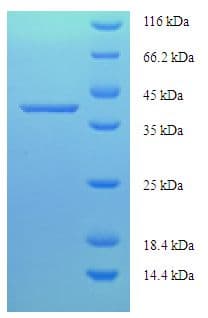 Human LARP1B Protein (Recombinant His-SUMO)