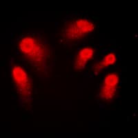 AIRE Antibody (Internal)