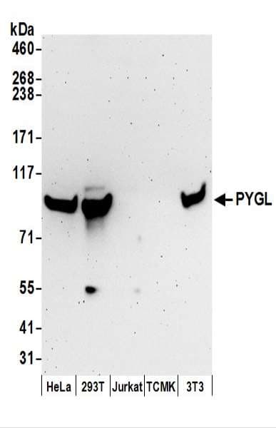 PYGL Antibody (aa797-847)